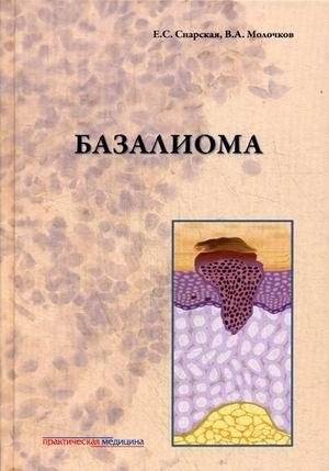 Базалиома | Basalioma
